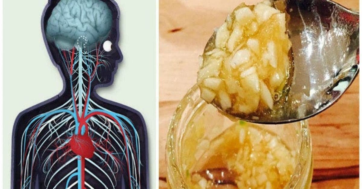 Knoblauch und Honig auf leeren Magen haben. Nach einer Woche wird Ihr Koerper veraendert ...