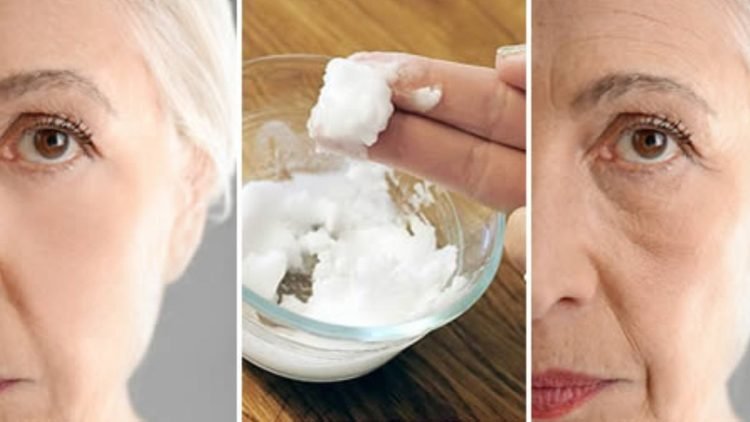 comment se debarrasser des rides avec du bicarbonate de soude et du citron 750x422 1